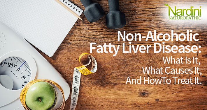 Non-Alcoholic Fatty Liver Disease: What Is It, What Causes It, And How To Treat It. | Nardini Naturopathic