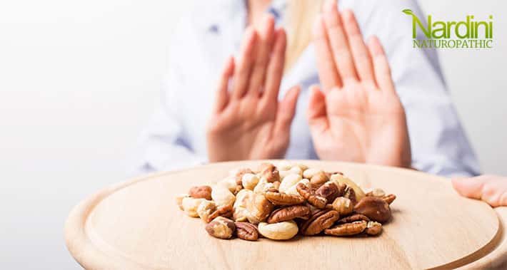 the difference between food allergies and food sensitivities | Nardini Naturopathic | Toronto Naturopath Clinic